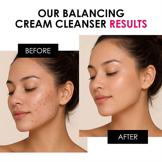 skinChemists Balancing Vitamin C & Glycolic Acid Cream Cleanser 200ml - For Acne, Blemishes & Large Pores