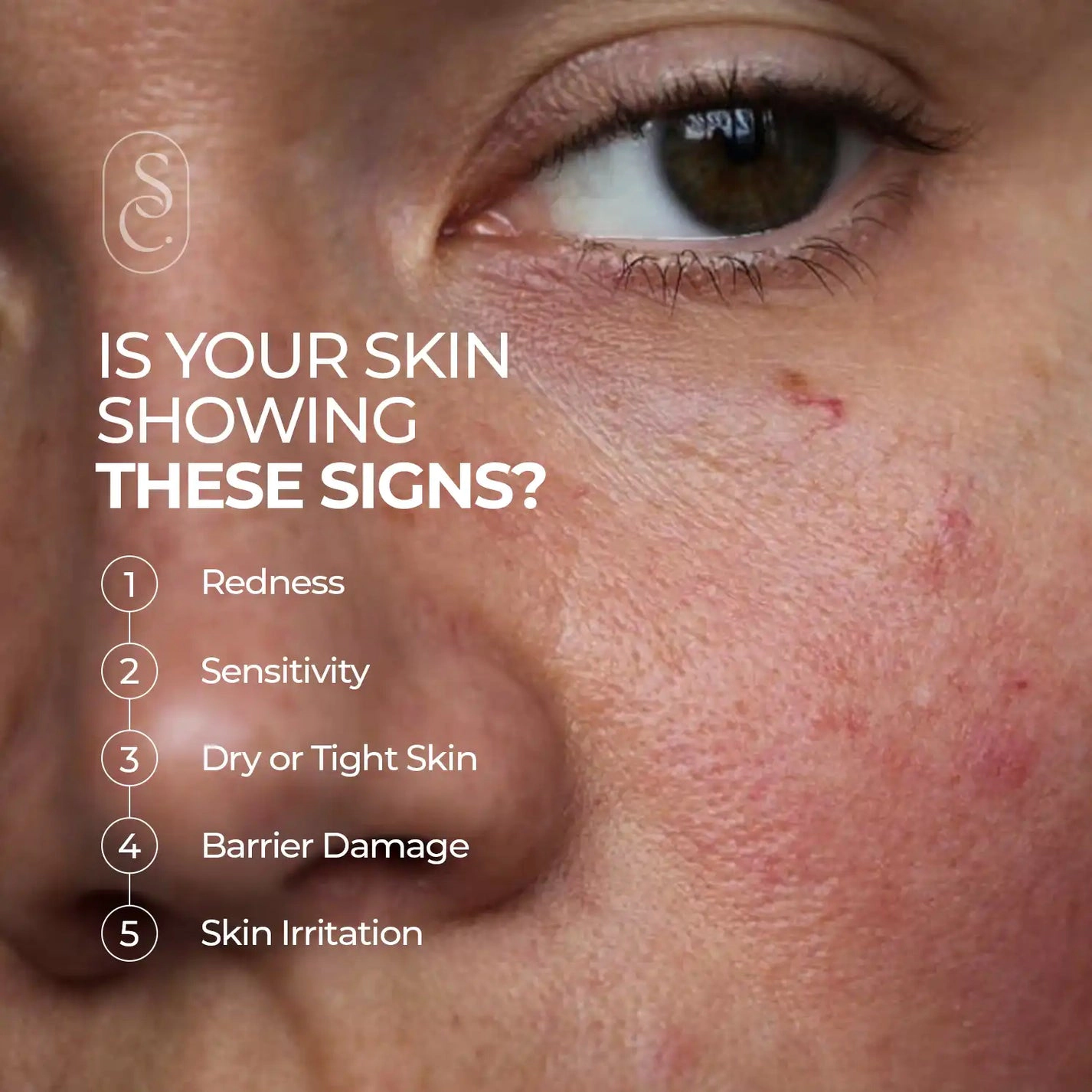 Skin Centrick – Advanced Skin Repair Serum