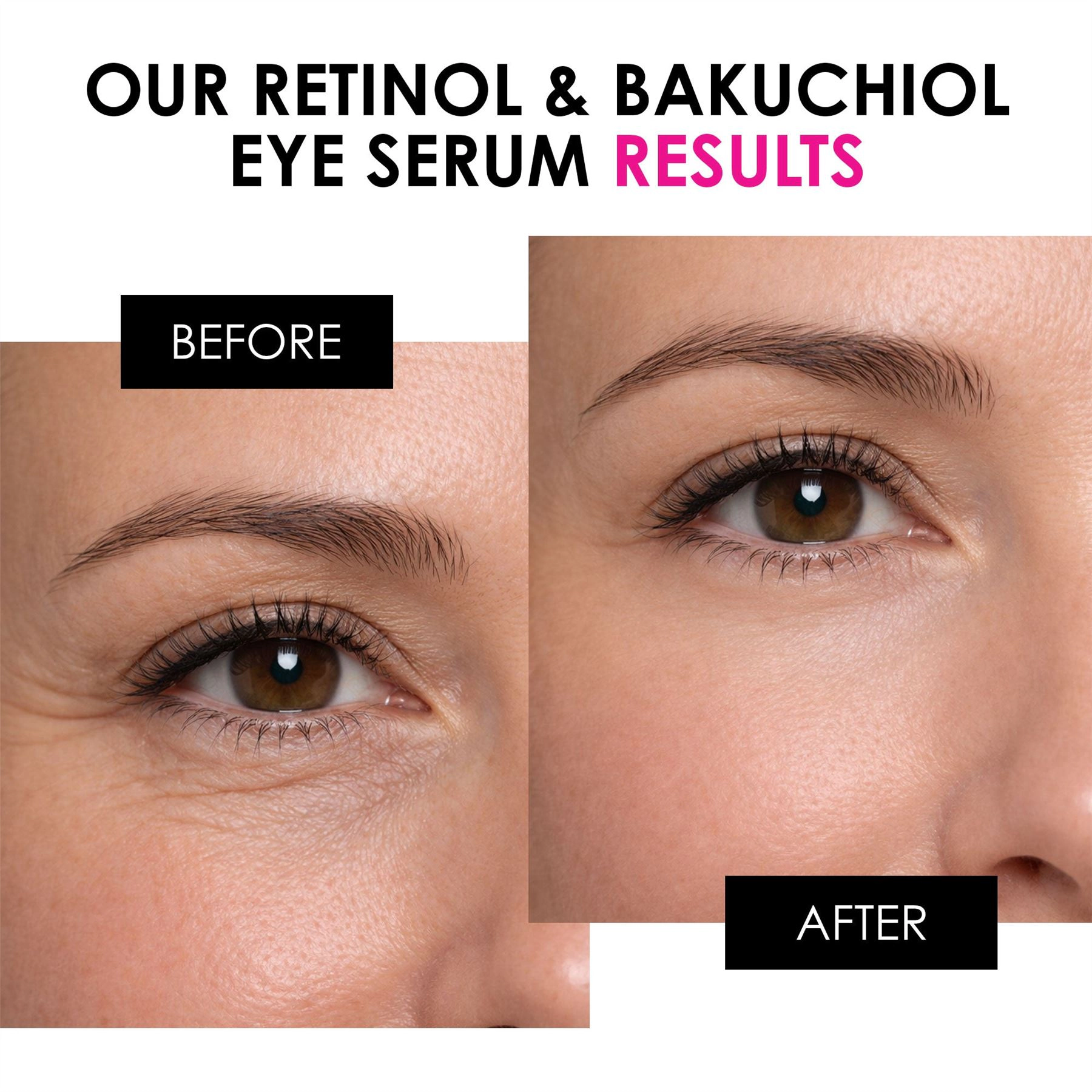 skinChemists Youth Series Retinol & Bakuchiol Eye Serum 15ml - Firms, Smooths Fine Lines & Wrinkles