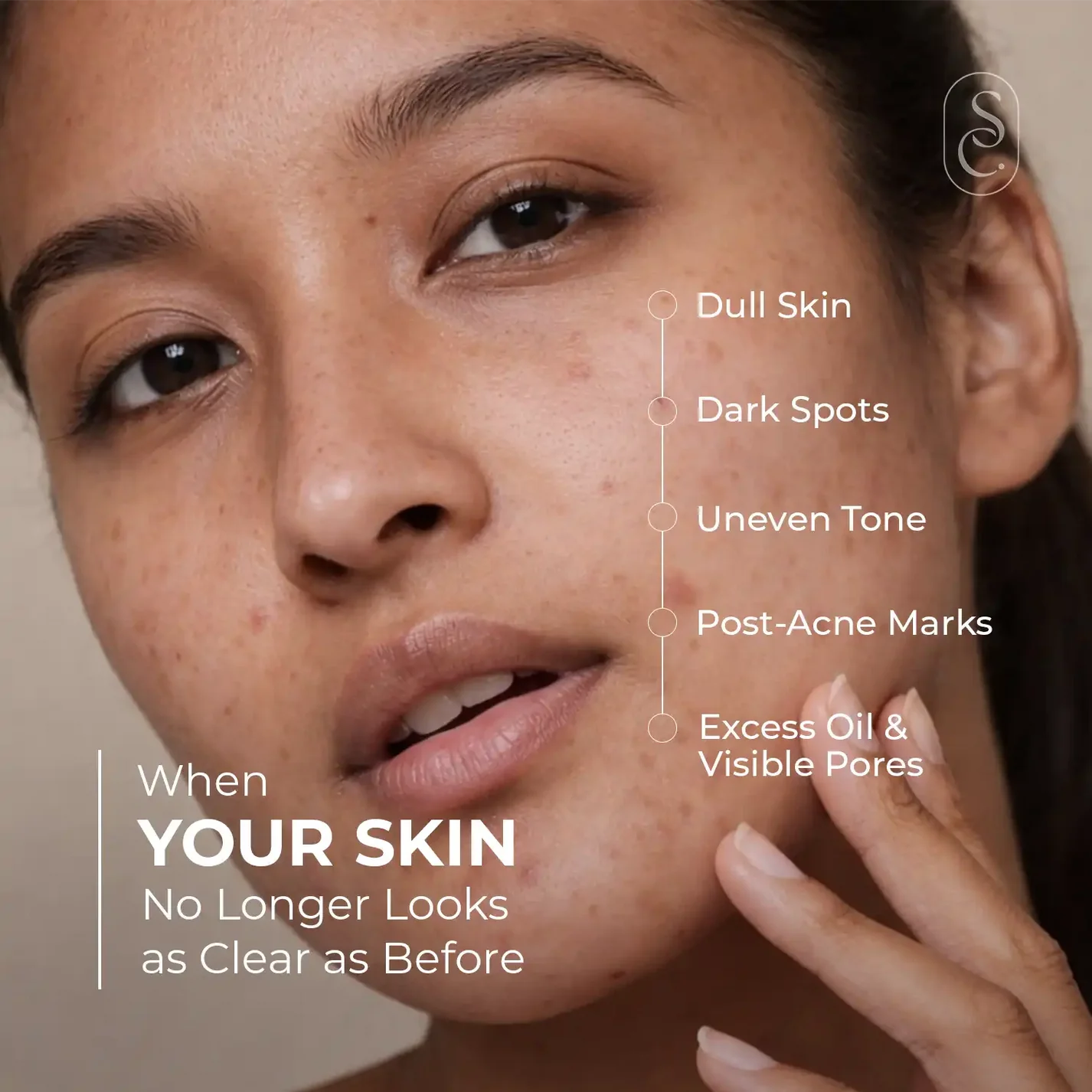 Skin Centrick Powerful Corrector Serum – Dark Spot Correcting & Brightening Face Serum