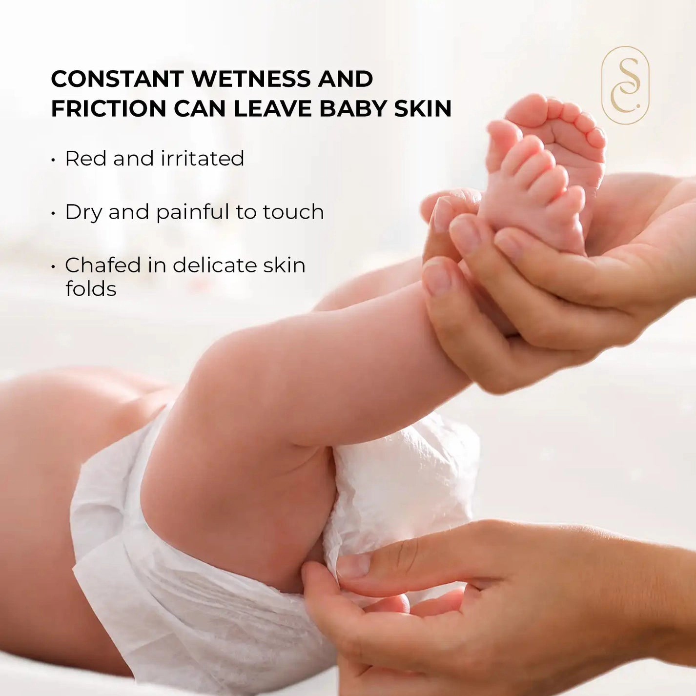 Skin Centrick Baby Diaper Rash Cream - Zinc Oxide Skin Protectant, Soothing Aloe & Coconut Oil, 100 ml