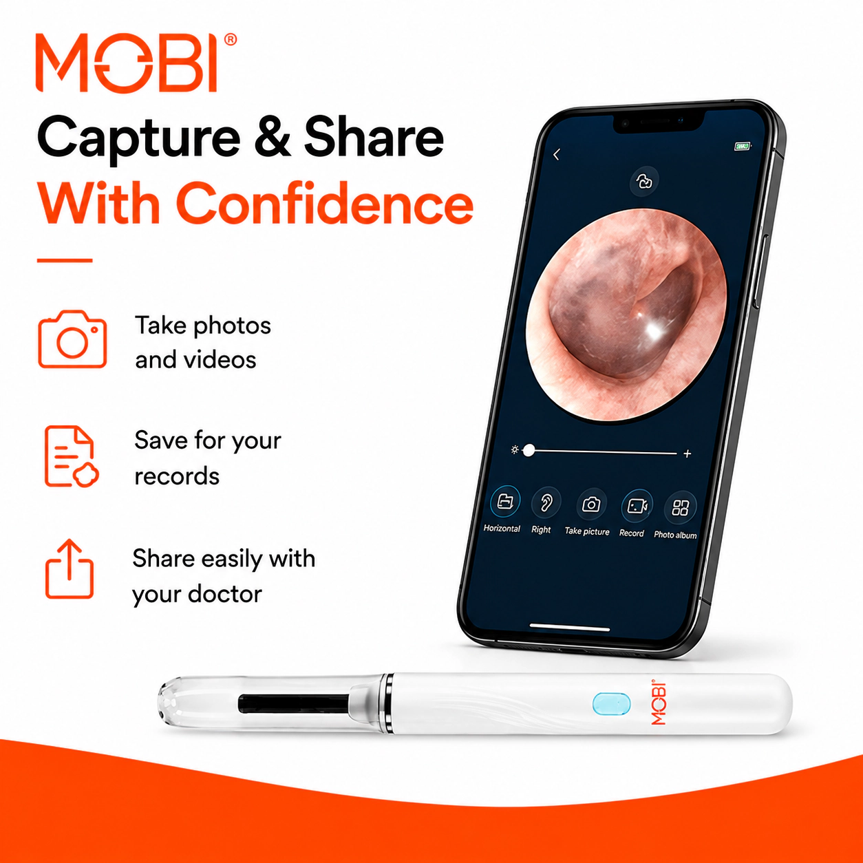 MOBI Smart Ear, Nose & Throat Camera