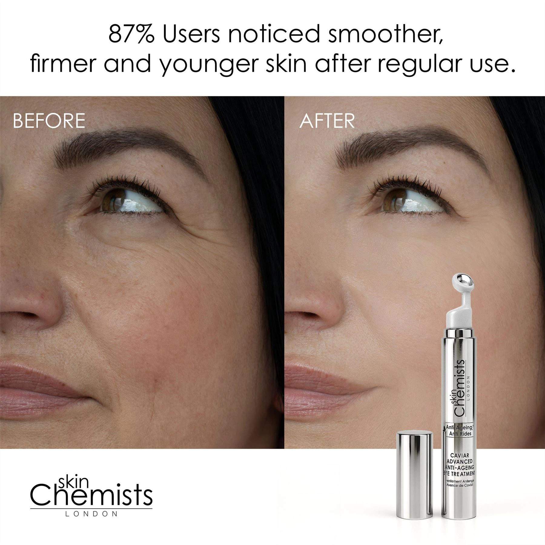 skinChemists Caviar Advanced Anti-Ageing Eye Treatment 15ml - Firming Peptide Complex, Aloe Vera - Anti-Ageing Eye Cream
