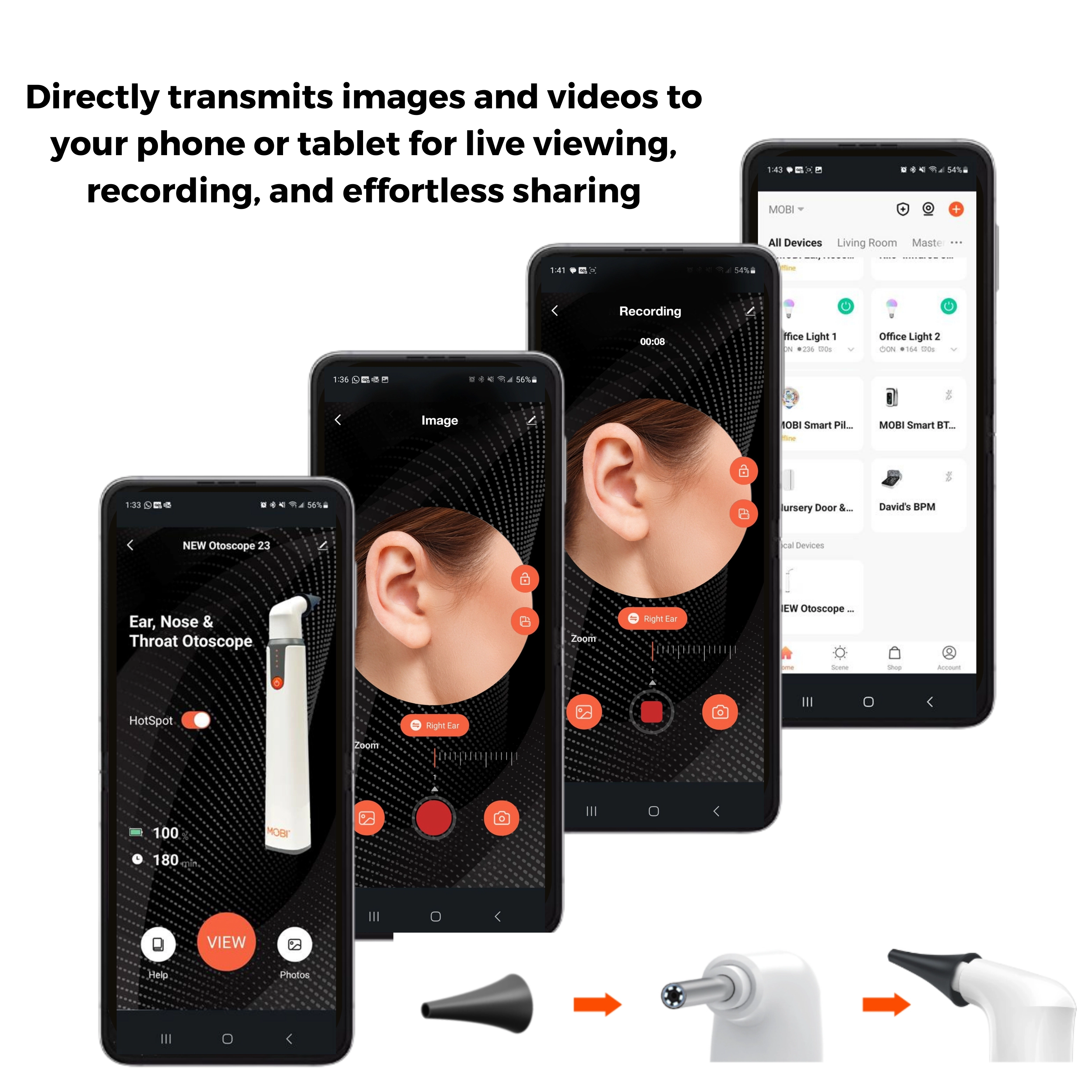 MOBI Smart EarCam Otoscope – 1080P HD with LED & Gyroscope