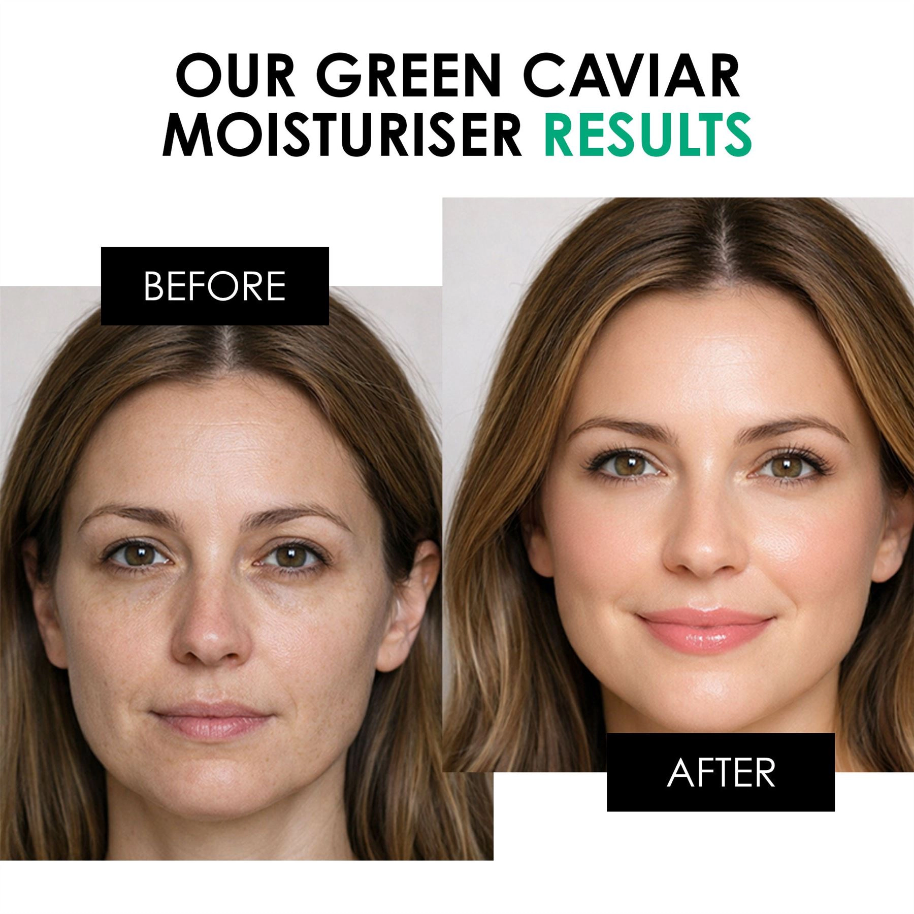 skinChemists Youth Series Green Caviar Day Moisturiser 30ml - Anti-Aging for Fine Lines & Dryness