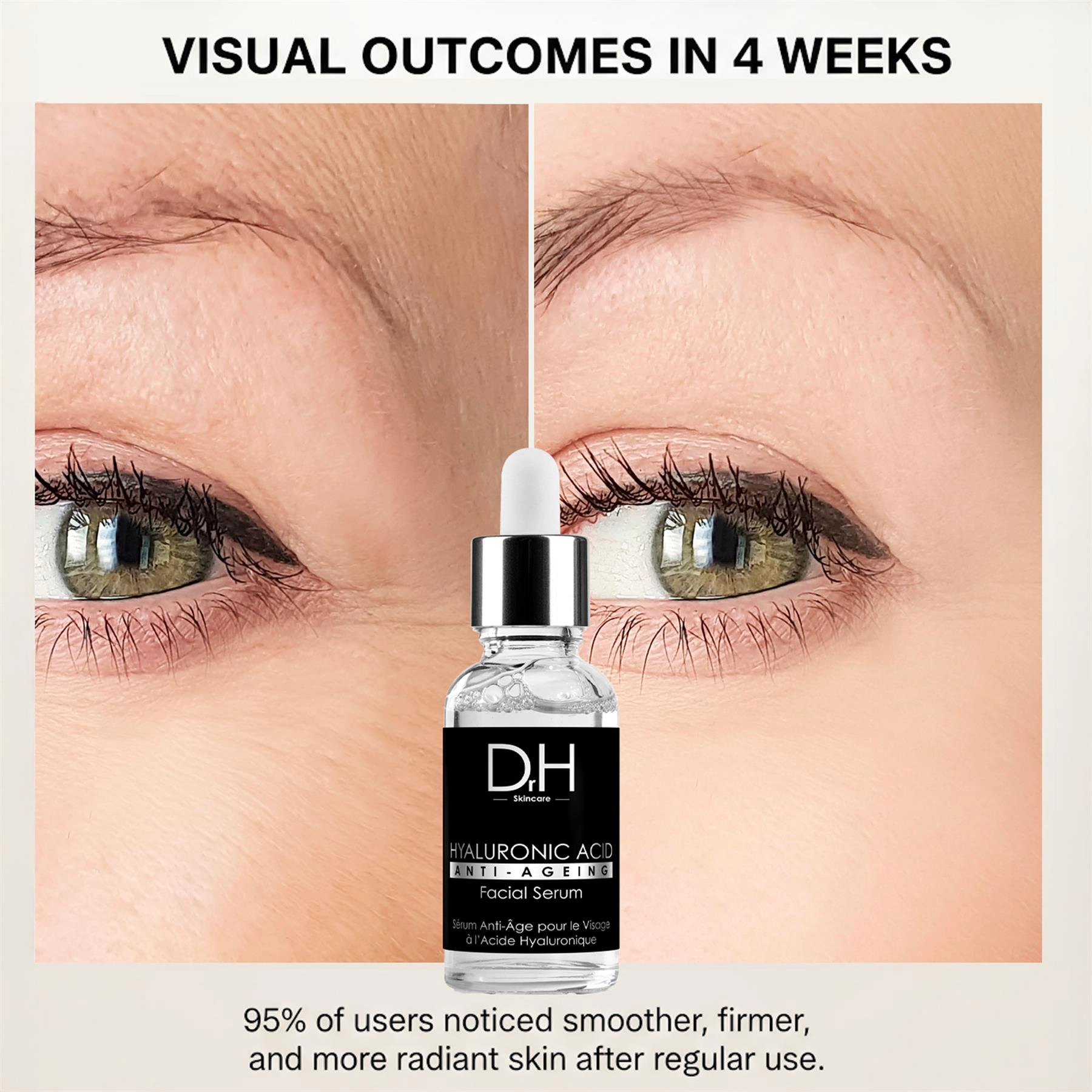 Anti-Ageing Hyaluronic Acid Facial Serum 30ml for Dryness, Fine Lines & Wrinkles