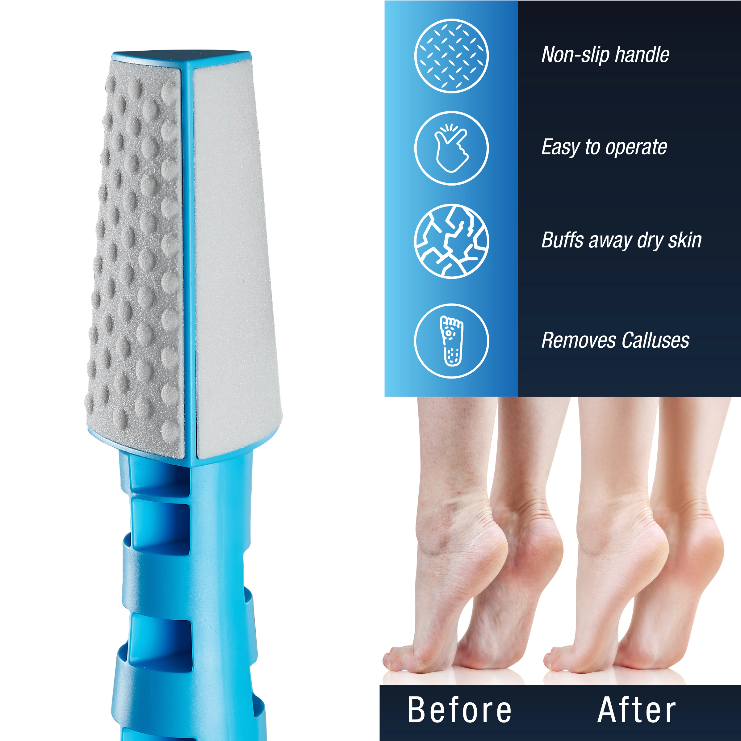 Pursonic Unisex 3 In 1 Callus Remover