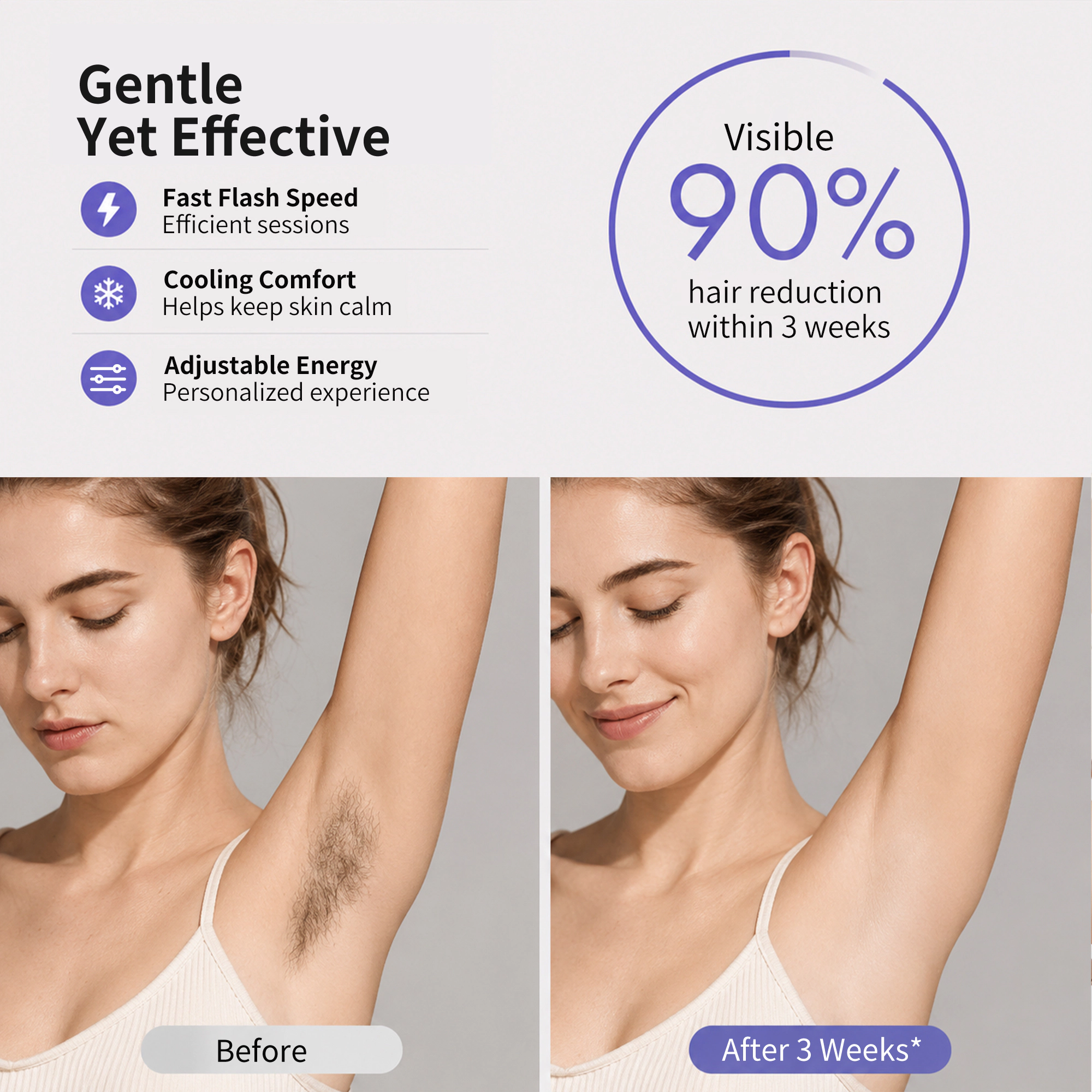 NICEBAY IPL Hair Removal Device – 4 Energy Modes with Sapphire Cooling – Hair Reduction at Home
