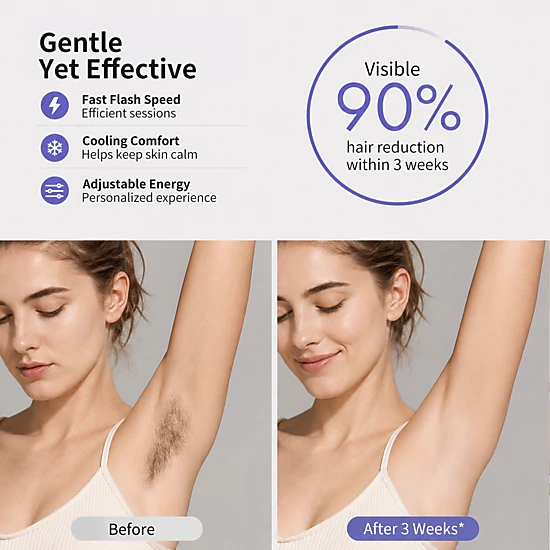 NICEBAY IPL Hair Removal Device – 4 Energy Modes with Sapphire Cooling – Hair Reduction at Home