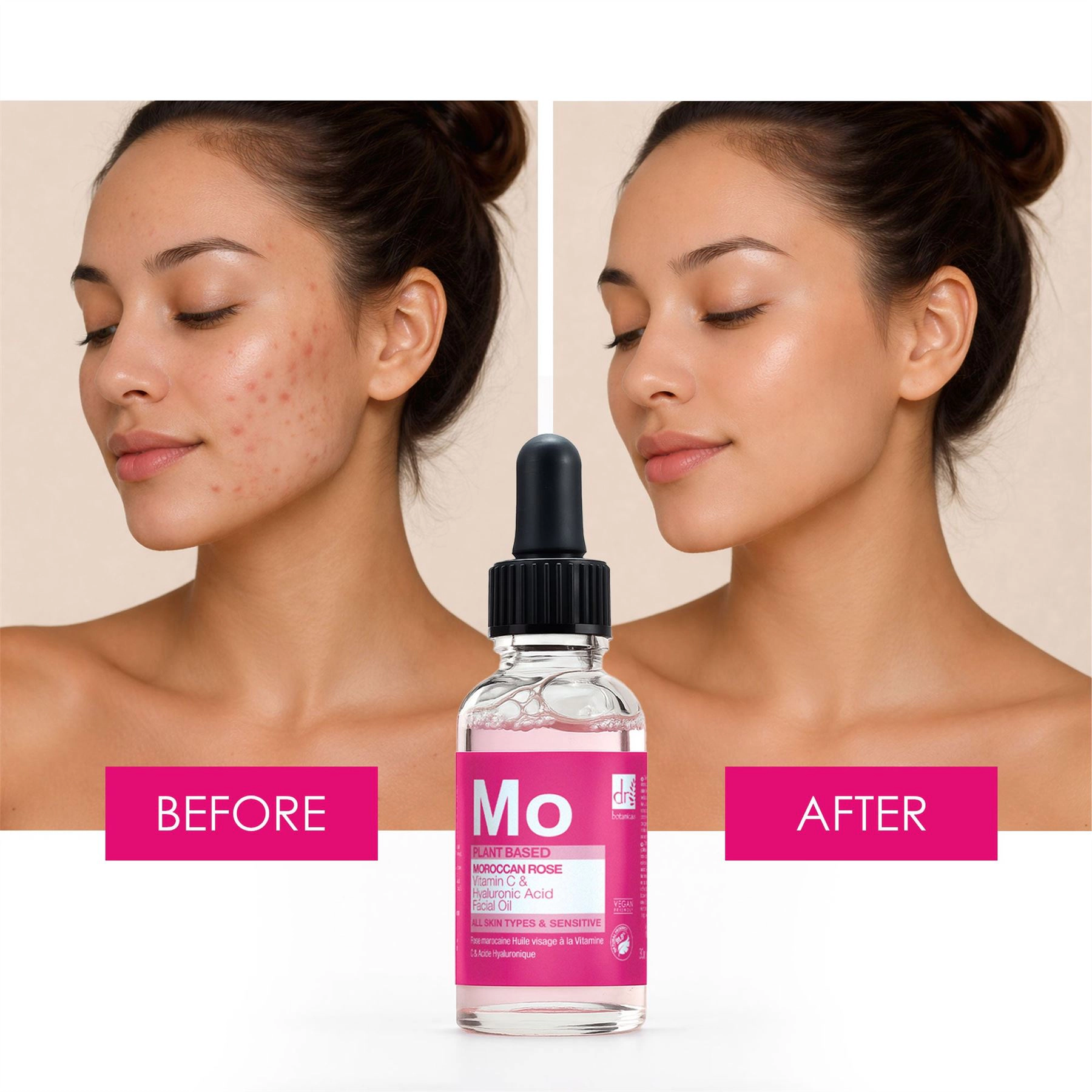 Dr Botanicals Moroccan Rose Facial Oil with Hyaluronic Acid & Vitamin C 15ml