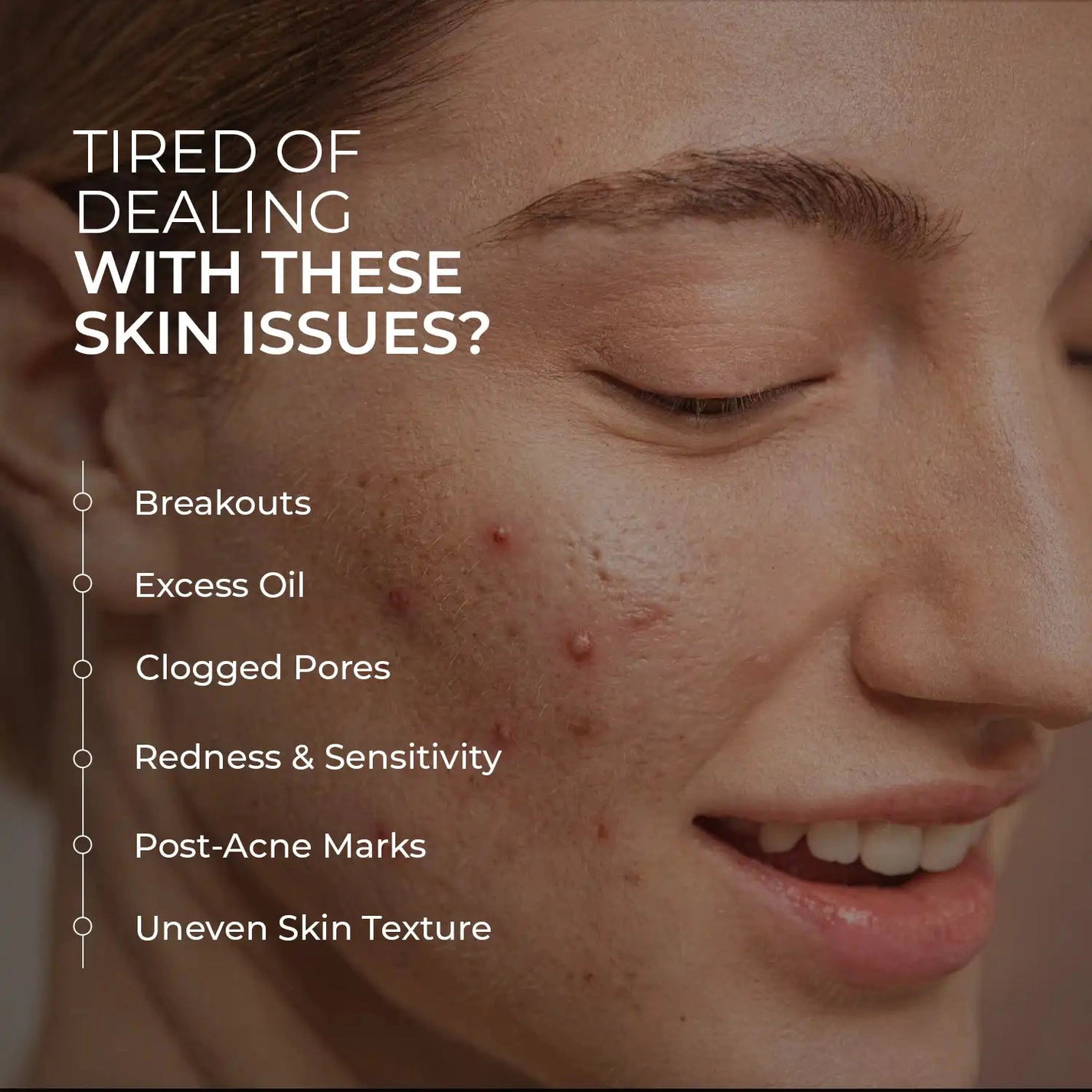 Skin Centrick – Acne Toner – Face Toner