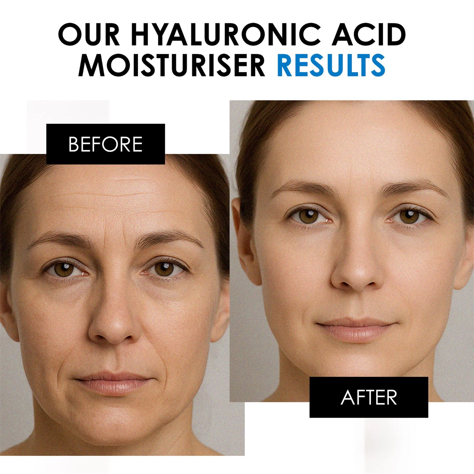 skinChemists Hyaluronic Acid Day Moisturiser 50ml - Hydrating Anti-Aging Cream for Dryness, Fine Lines & Wrinkles