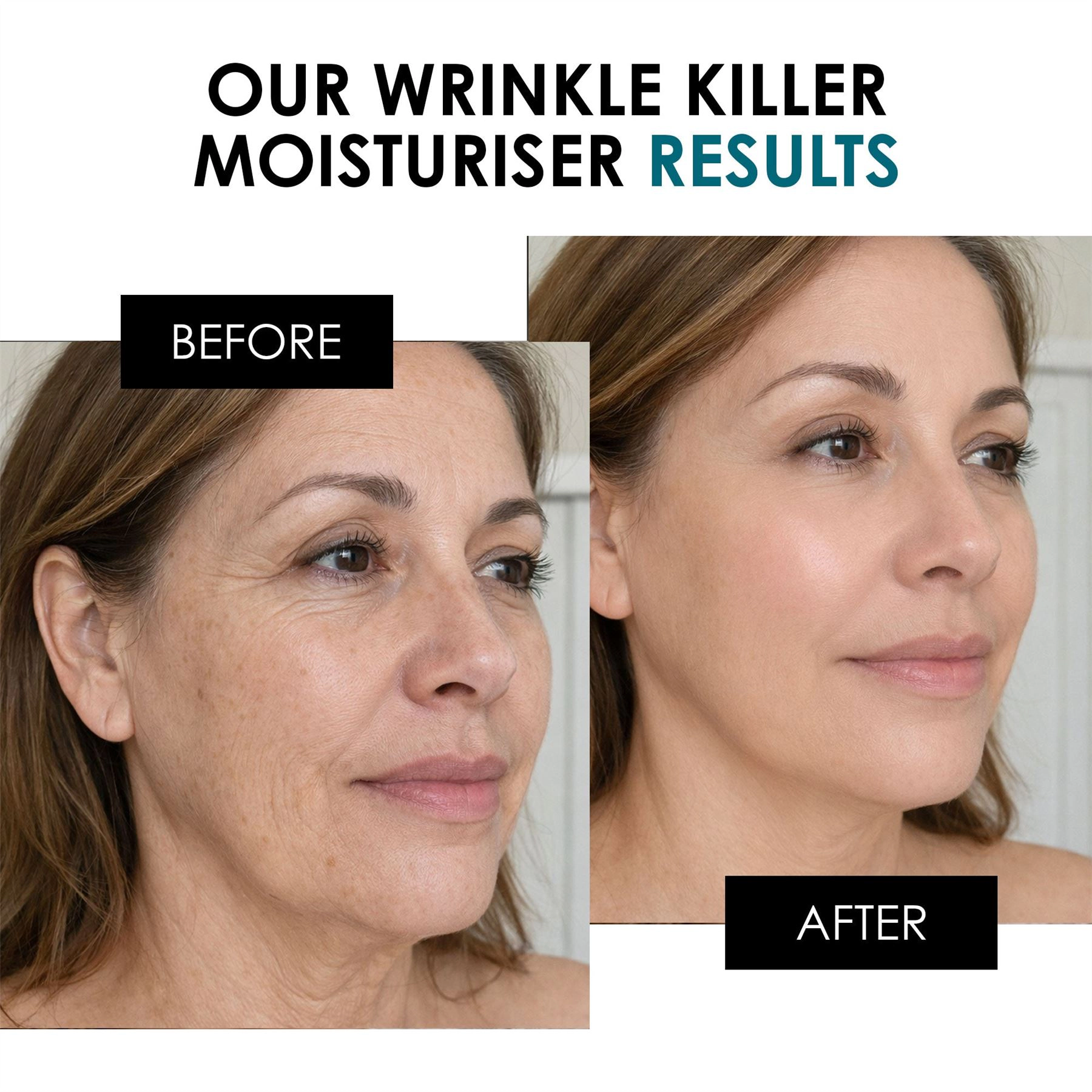 skinChemists Wrinkle Killer Day Moisturiser 50ml - Firming, Smoothing, Hydrating